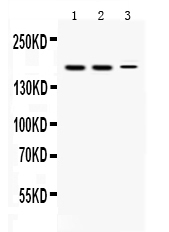 1 - Anti-KDM5B Picoband Antibody ABO11691