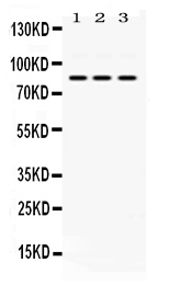 1 - Anti-KRIT1 Picoband Antibody ABO11692