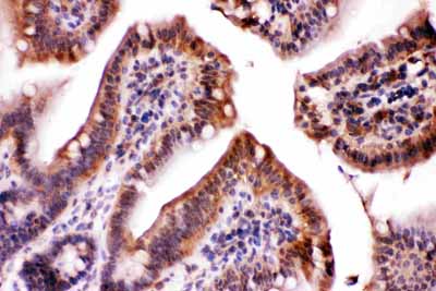 2 - Anti-LDHA Picoband Antibody ABO11693
