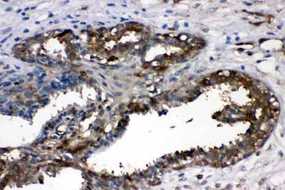 2 - Anti-LDHA Picoband Antibody ABO11693