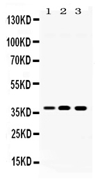 1 - Anti-LDHA Picoband Antibody ABO11693