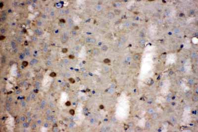 2 - Anti-LDHB Picoband Antibody ABO11694