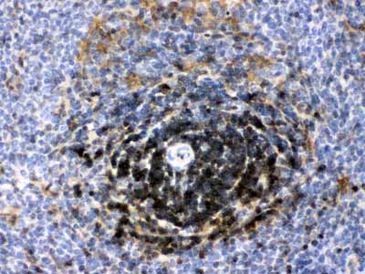2 - Anti-LDHB Picoband Antibody ABO11694