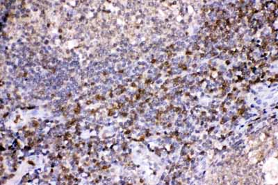 2 - Anti-LDHB Picoband Antibody ABO11694