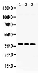 1 - Anti-LDHB Picoband Antibody ABO11694