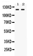 1 - Anti-LRIG3 Picoband Antibody ABO11695