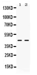 1 - Anti-NR2F6 Picoband Antibody ABO11699