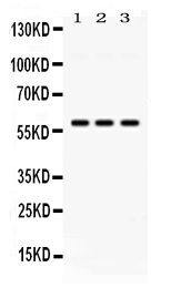 1 - Anti-PIAS4 Picoband Antibody ABO11700