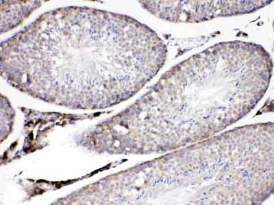 2 - Anti-ADFP Picoband Antibody ABO11701
