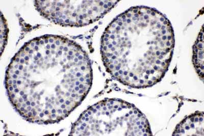 2 - Anti-ADFP Picoband Antibody ABO11701