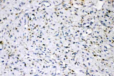 2 - Anti-ADFP Picoband Antibody ABO11701