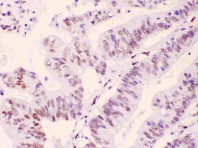 2 - Anti-PML Protein Picoband Antibody ABO11702