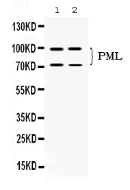 1 - Anti-PML Protein Picoband Antibody ABO11702