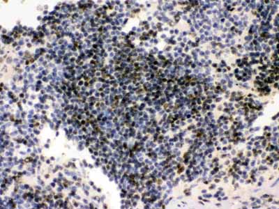 2 - Anti-PML Protein Picoband Antibody ABO11703