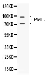 1 - Anti-PML Protein Picoband Antibody ABO11703
