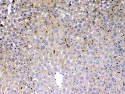 2 - Anti-PSAT1 Picoband Antibody ABO11704