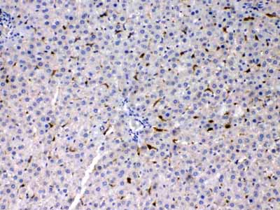 2 - Anti-PSAT1 Picoband Antibody ABO11704