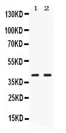 1 - Anti-PSAT1 Picoband Antibody ABO11704