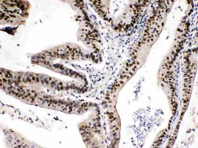 2 - Anti-PSMA1 Picoband Antibody ABO11705