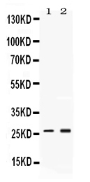 1 - Anti-PSMA2 Picoband Antibody ABO11706