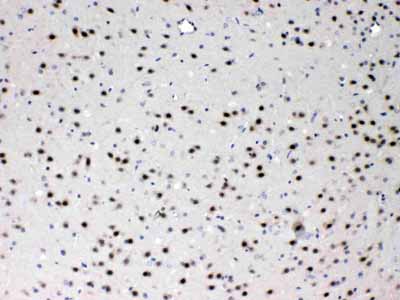 2 - Anti-PSMA3 Picoband Antibody ABO11707