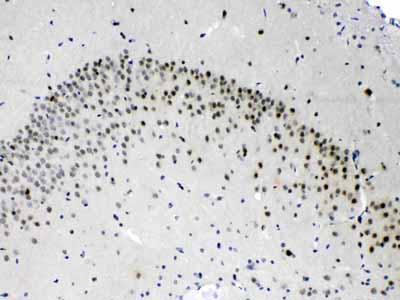 2 - Anti-PSMA3 Picoband Antibody ABO11707