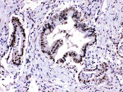 2 - Anti-PSMA3 Picoband Antibody ABO11707