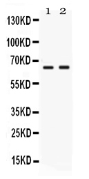 1 - Anti-Nectin-4/PVRL4 Picoband Antibody ABO11709