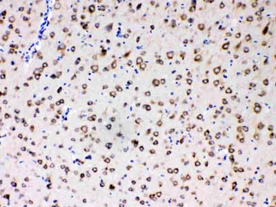 2 - Anti-MPS1 Picoband Antibody ABO11711