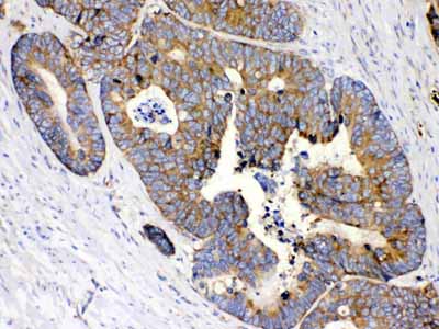 2 - Anti-MPS1 Picoband Antibody ABO11711