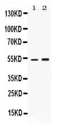 1 - Anti-SERPINA1 Picoband Antibody ABO11715