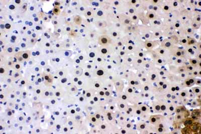2 - Anti-PC4 Picoband Antibody ABO11716