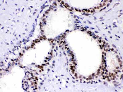 2 - Anti-PC4 Picoband Antibody ABO11716