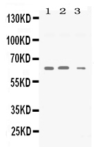 1 - Anti-Synapsin II Picoband Antibody ABO11718