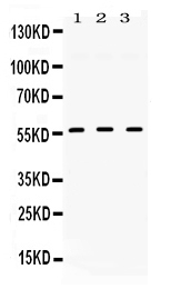 1 - Anti-TGFBR1 Picoband Antibody ABO11719