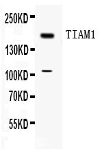 1 - Anti-TIAM1 Picoband Antibody ABO11721