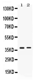1 - Anti-TNFRSF14/HVEM Picoband Antibody ABO11722