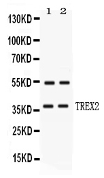 1 - Anti-TREX2 Picoband Antibody ABO11723