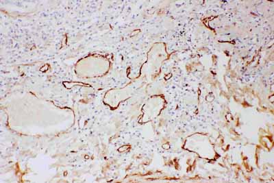 2 - Anti-Adiponectin Picoband Antibody ABO11726