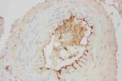 2 - Anti-Adiponectin Picoband Antibody ABO11726