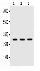 1 - Anti-Adiponectin Picoband Antibody ABO11726