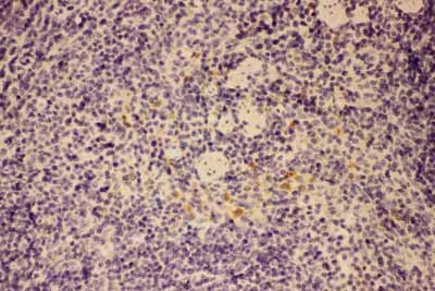 2 - Anti-GM-CSF Picoband Antibody ABO11728