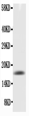 1 - Anti-GM-CSF Picoband Antibody ABO11728
