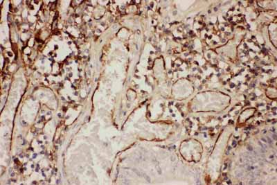 2 - Anti-ICAM-1 Antibody ABO11729