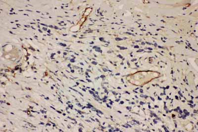 2 - Anti-ICAM-1 Antibody ABO11729
