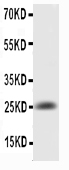 1 - Anti-IL-6 Antibody ABO11730