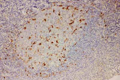 2 - Anti-IL-18 Antibody ABO11731