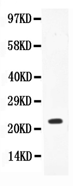 1 - Anti-IL-18 Antibody ABO11731