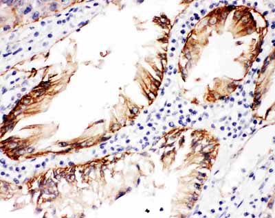 2 - Anti-Integrin Beta 4 Picoband Antibody ABO11732