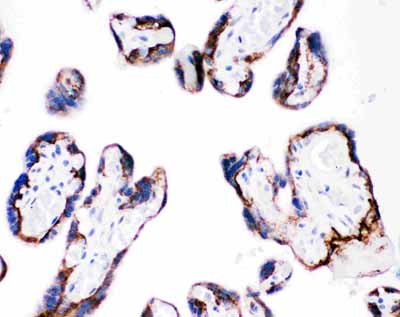 2 - Anti-Integrin Beta 4 Picoband Antibody ABO11732